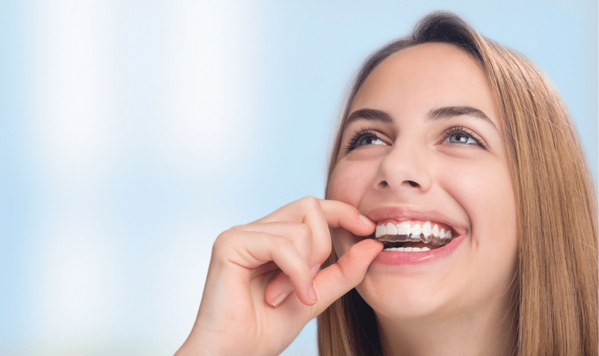 SIX THINGS TO CONSIDER BEFORE BEGINNING INVISALIGN TREATMENT