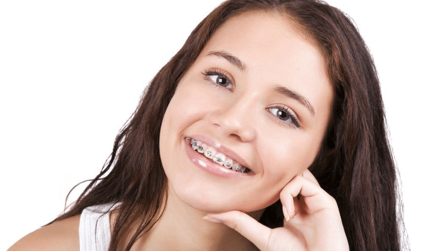 Dental Hygienist Tips for Teens With Braces