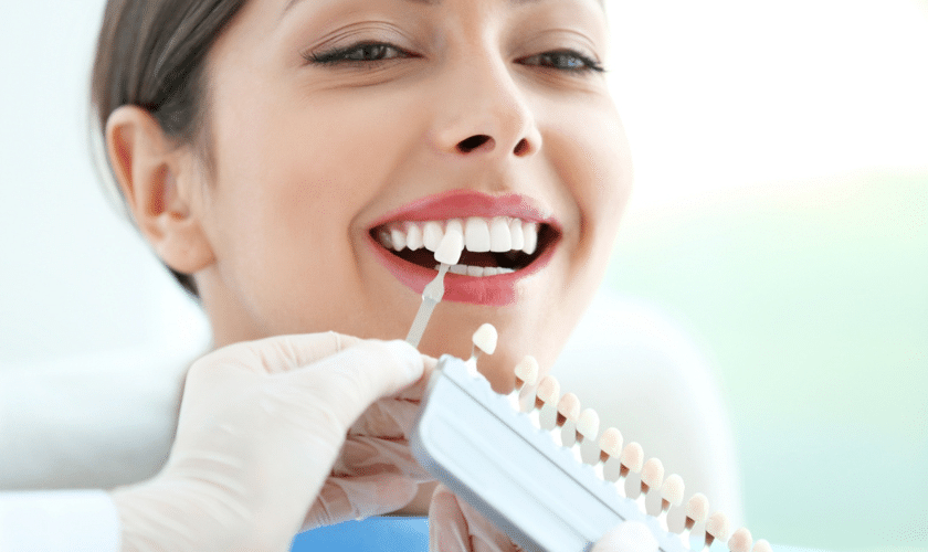 Understanding Dental Veneers and Their Benefits